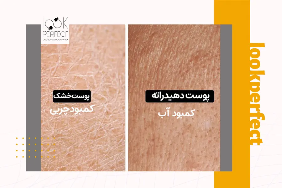 تفاوت پوست چرب دهیدراته و پوست خشک