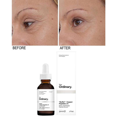 سرم بافه پپتاید مس اوردینری + (2) بافه پپتاید مس 1 درصد اوردینری