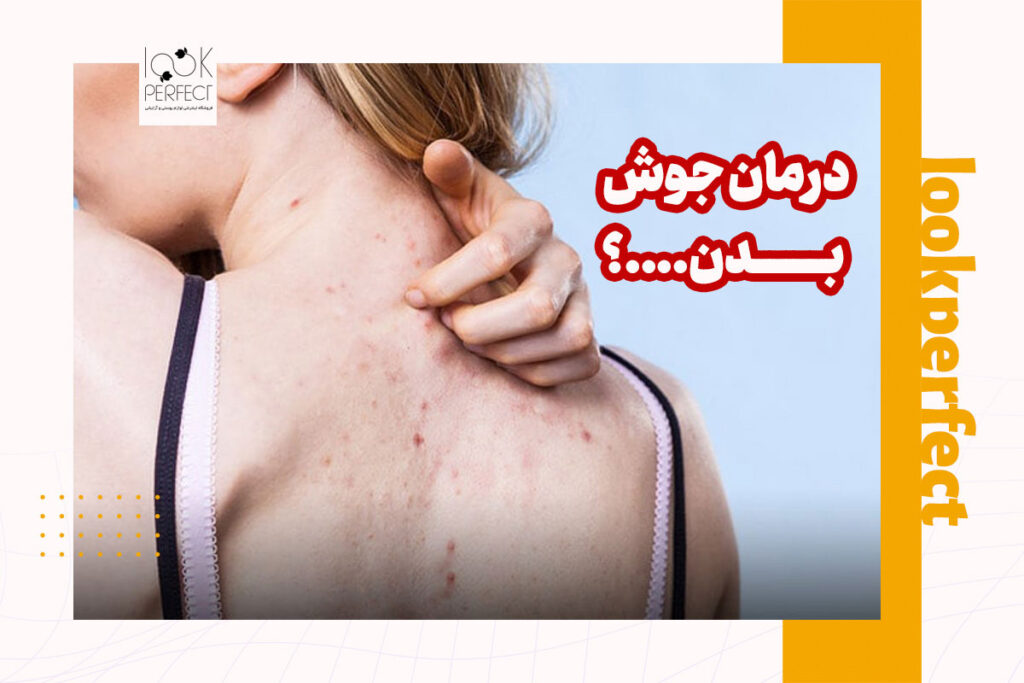 درمان جوش‌های بدن