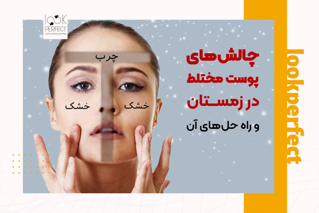 نواحی مختلف پوست مختلط: ناحیه T چرب و نواحی گونه خشک که در زمستان نیاز به مراقبت‌های خاص دارند