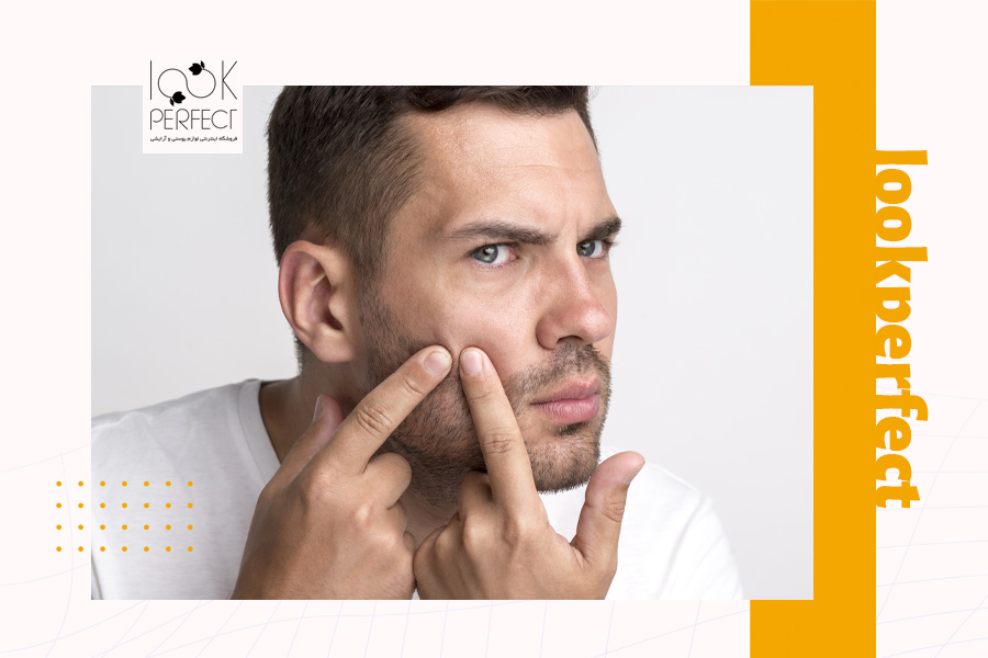 مردی که در حال بررسی و فشار دادن جوشهای روی صورت خود در آینه است – تأکید بر عدم دستکاری جوشها برای جلوگیری از التهاب