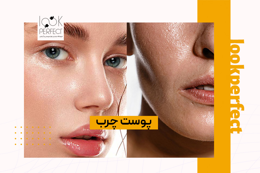 تصویری از پوست چرب که برق افتاده و مستعد جوش است. افرادی که پوست چرب دارند، معمولاً در ناحیه T (پیشانی، بینی و چانه) چربی بیشتری حس می‌کنند. اگر شک داری که پوستت چرب است یا نه، روش‌های تشخیص نوع پوست در خانه را امتحان کن و از محصولات مناسب برای کنترل چربی استفاده کن