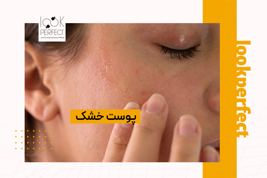 مای نزدیک از پوست خشک که دچار پوسته‌پوسته شدن و کشیدگی شده است. اگر حس می‌کنی پوستت بعد از شستشو به شدت خشک می‌شود، احتمال دارد پوست خشکی داشته باشی. در این مقاله، راه‌های ساده برای تشخیص نوع پوست در خانه و انتخاب محصولات آبرسان مناسب را یاد می‌گیری.