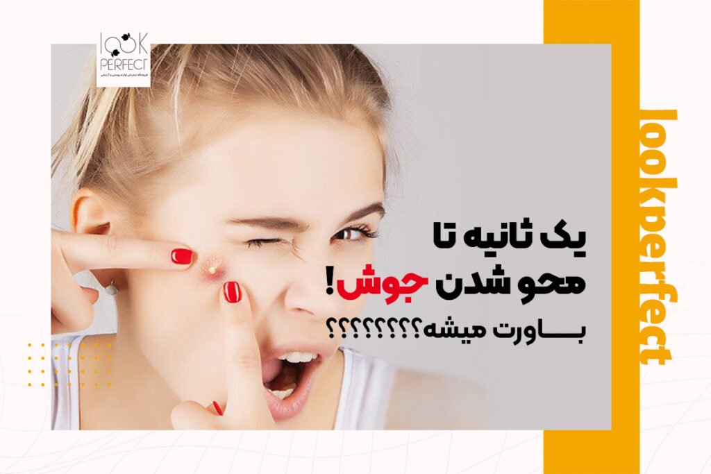 دختر جوانی که با انگشت در حال فشار دادن یک جوش بزرگ روی صورتشه، با حالت چهره متعجب و ناراحت؛ تاکید تصویری بر آزاردهنده بودن جوش‌های ناگهانی و نیاز به درمان فوری.