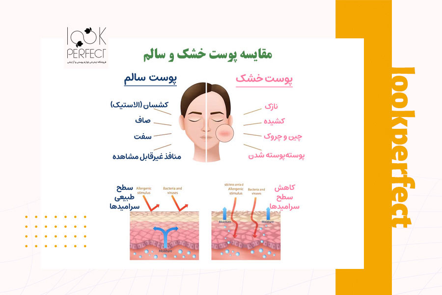 مقایسه پوست سالم و پوست خشک در قالب نمودار، همراه با ویژگی‌های الاستیسیته، صافی، و حضور یا نبود چروک‌ها و منافذ