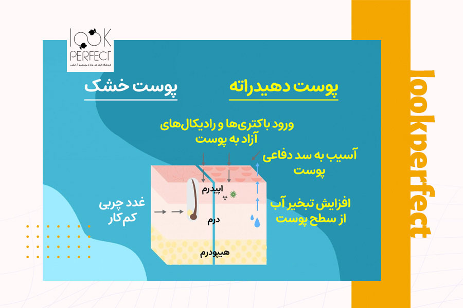 صویر گرافیکی از ساختار پوست خشک و دهیدراته، همراه با نشانه‌هایی از غدد چربی کم‌کار و تبخیر آب از سطح پوست