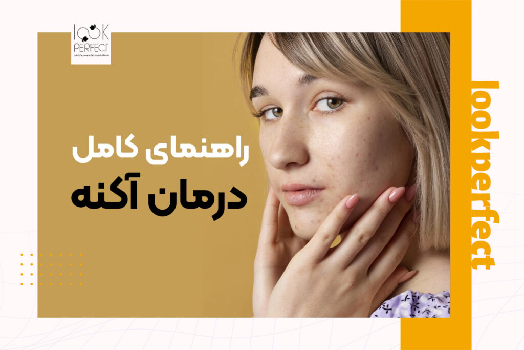 درمان آکنه
