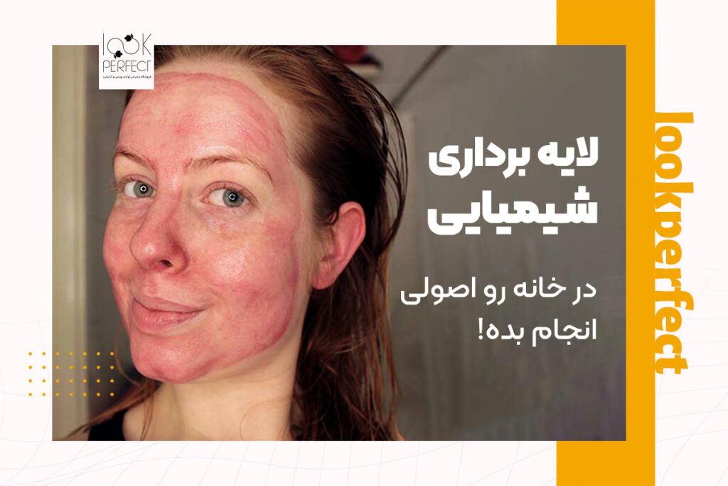 نمونه‌ای از قرمزی پوست بعد از لایه‌برداری شیمیایی به‌عنوان هشدار رعایت اصول مصرف
