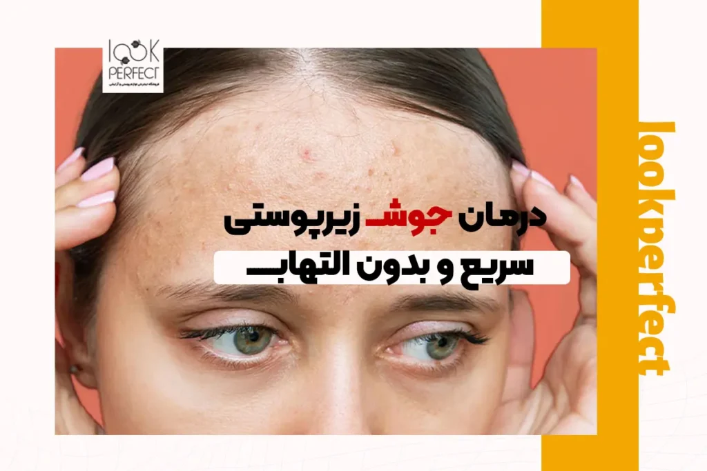 درمان جوش زیر پوستی