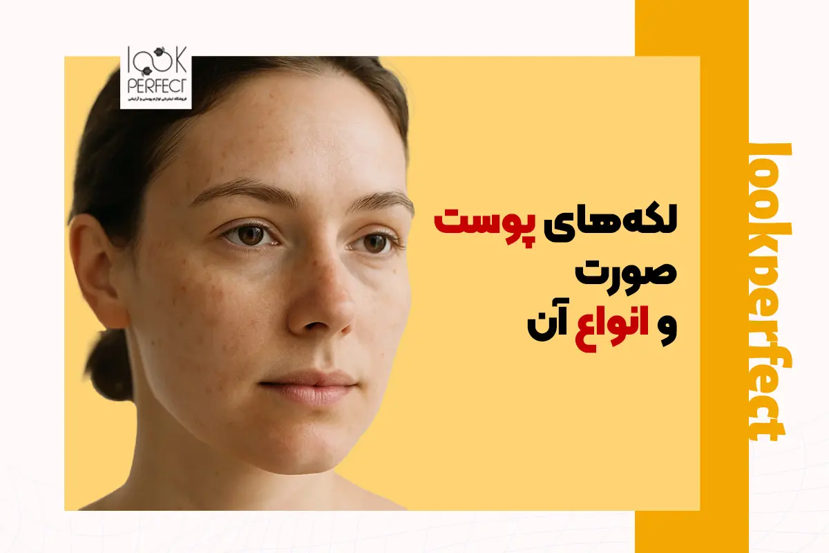 لکه های پوست صورت