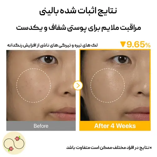 نتایج اثبات شده بالینی سرم ضد لک و روشن کننده نامبوزین شماره 5 بعد از 4 هفته استفاده از این محصول
