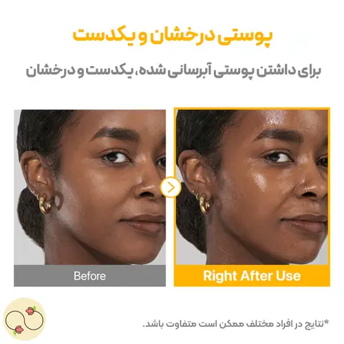 اثر استفاده از سرم ضد لک نامبوزین