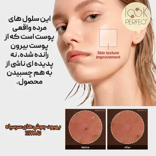 نتایج قبل و بعد بهبود بافت پوست با سرم برنج سیاه دکتر ملاکسین