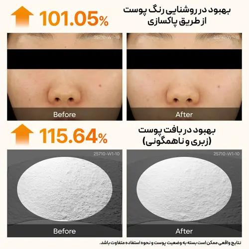 نتایج بالینی بهبود روشنایی رنگ پوست و رفع زبری و ناهمگونی با آمپول لایه بردار دکتر ملاکسین