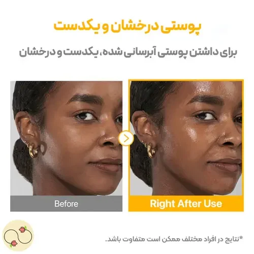 اثر استفاده از سرم ضد لک نامبوزین