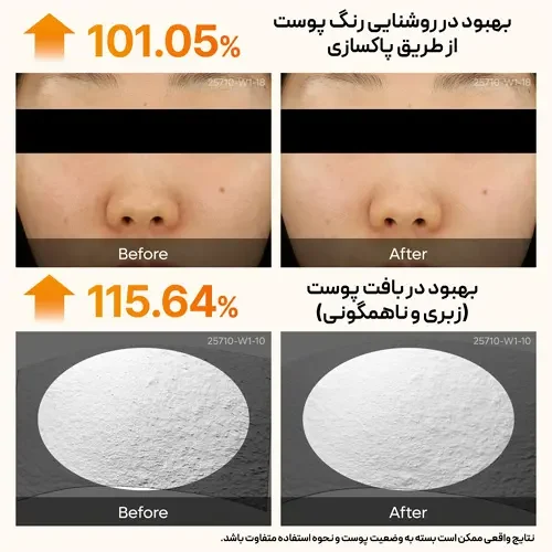 نتایج بالینی بهبود روشنایی رنگ پوست و رفع زبری و ناهمگونی با آمپول لایه بردار دکتر ملاکسین