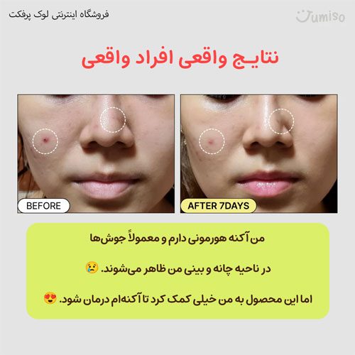 اسنس حلزون جومیسو اصل