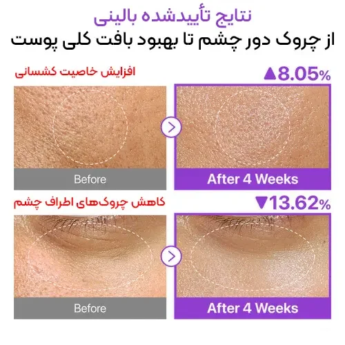قبل و بعد از استفاده از اسنس نامبوزین