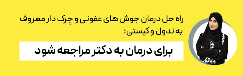 جوش چرکی