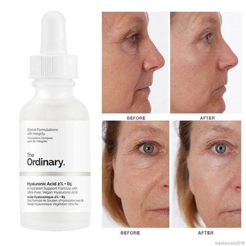 سرم هیالورونیک اسید اوردینری اصل
