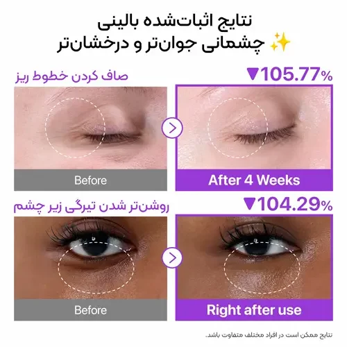 نتایج بالینی کرم دورچشم نامبوزین
